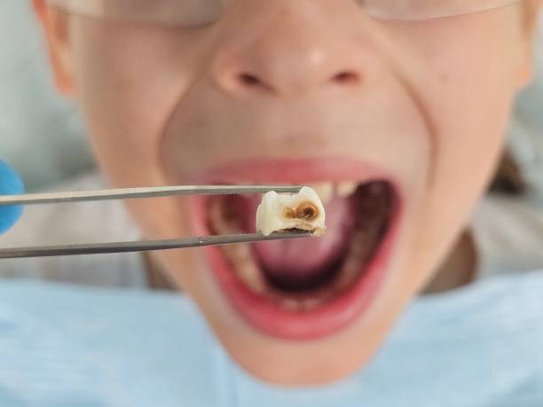 Best Pediatric Emergency Dentist in Southaven, MS